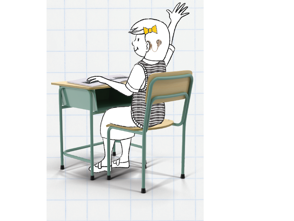 人工耳蜗的工作原理