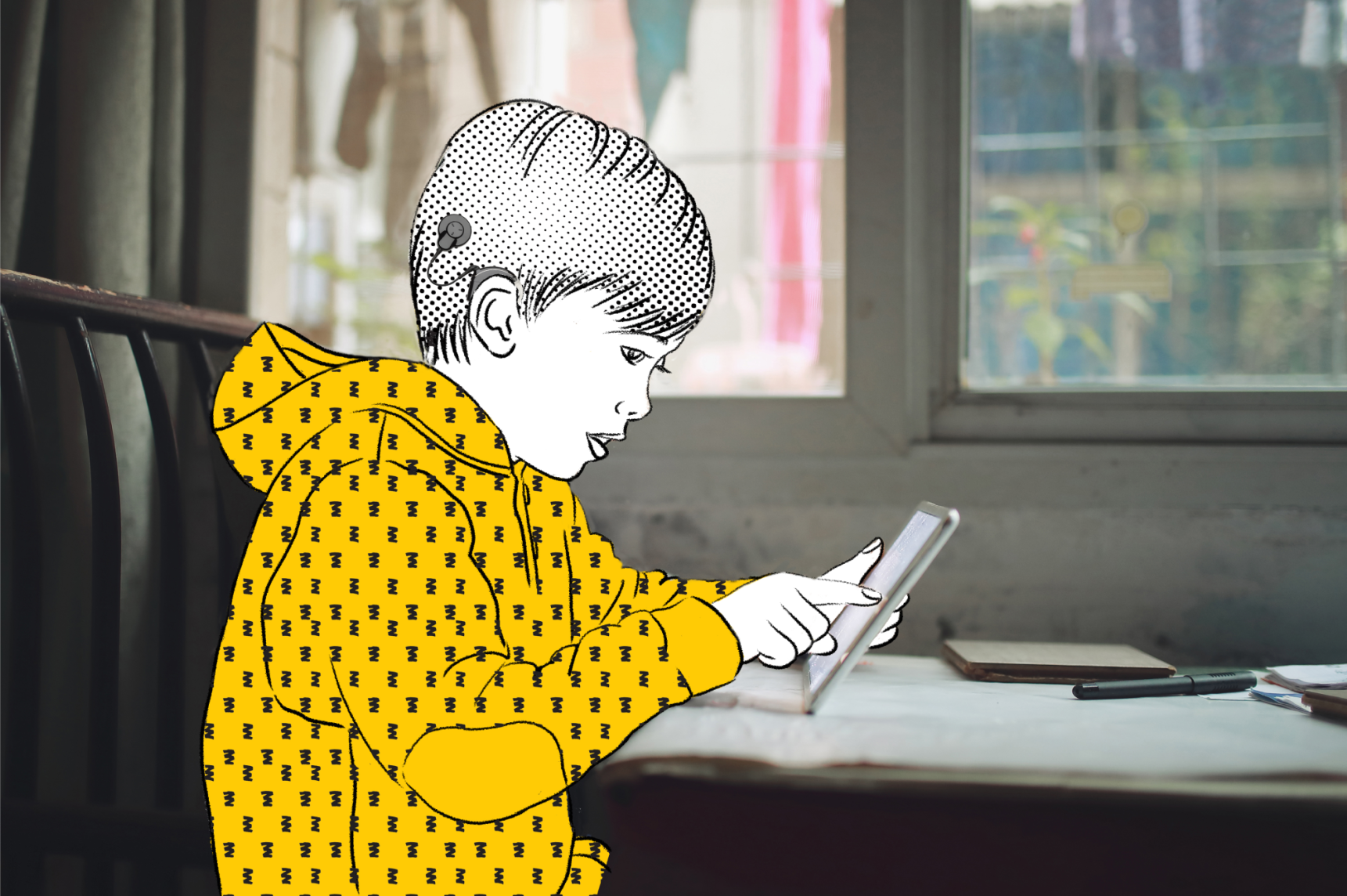 科利耳无线人工耳蜗配件 | 澳大利亚进口人工耳蜗 | 电子耳蜗