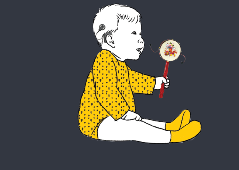 几岁儿童宝宝能植入人工耳蜗?宝宝先天性听损能植入人工耳蜗吗?科利耳儿童人工耳蜗植入品牌