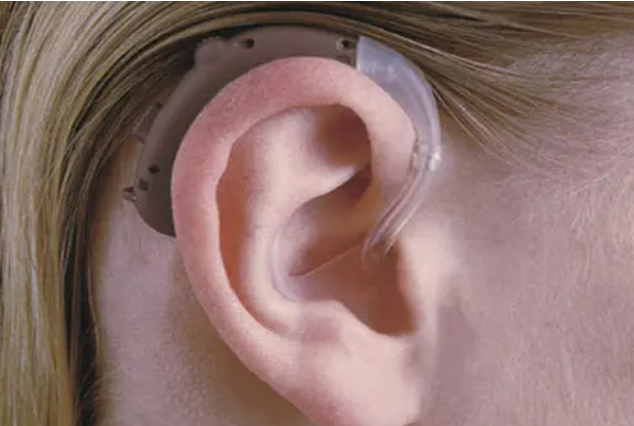 误区四：助听器不需要长期佩戴