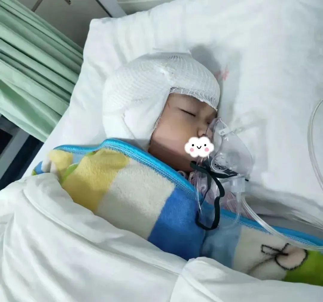 澳洲人工耳蜗植入案例 | 孩子重度感音神经性听力损失植入人工耳蜗案例
