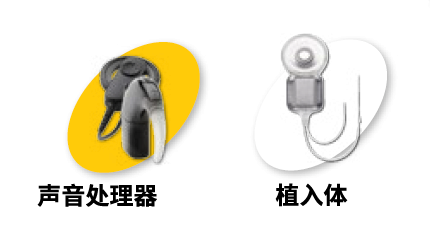 澳大利亚科利耳儿童智能人工耳蜗品牌